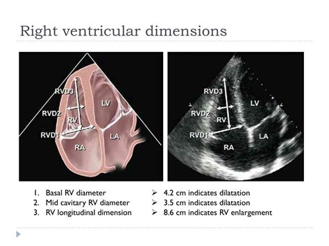 lv size echo|lv cavity size.